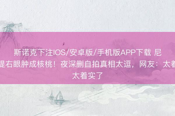 斯诺克下注IOS/安卓版/手机版APP下载 尼格买提右眼肿成核桃！夜深删自拍真相太逗，网友：太着实了